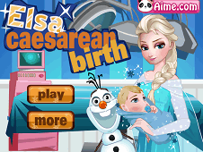 Elsa Caesarean Birth Online