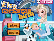 Elsa Caesarean Birth