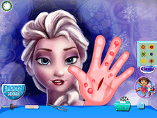Frozen Hand Surgery