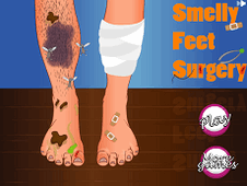 Smelly feet surgery