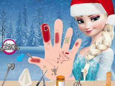 Frozen Elsas Hand Treatment 